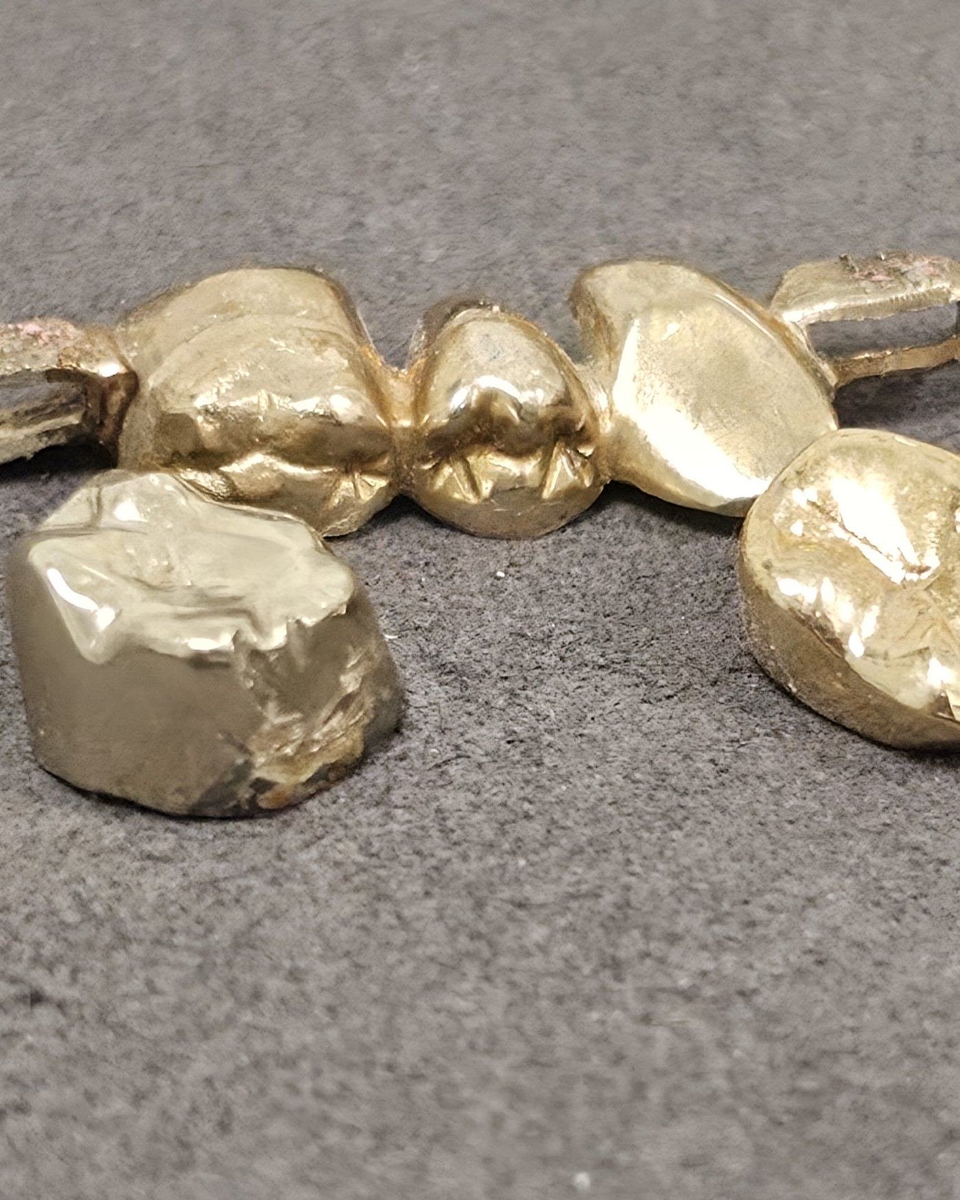Zahngold, Goldkronen und Brücken beim Zahngold-Ankauf in Regensburg